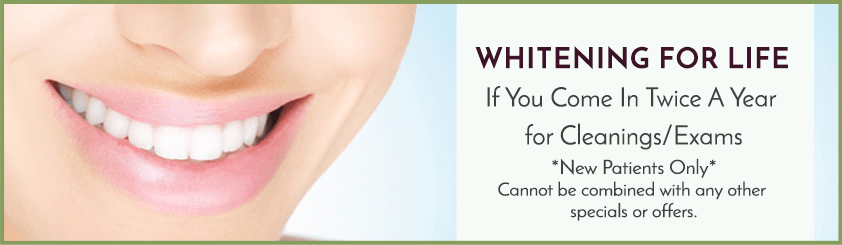 Teeth Whitening Service